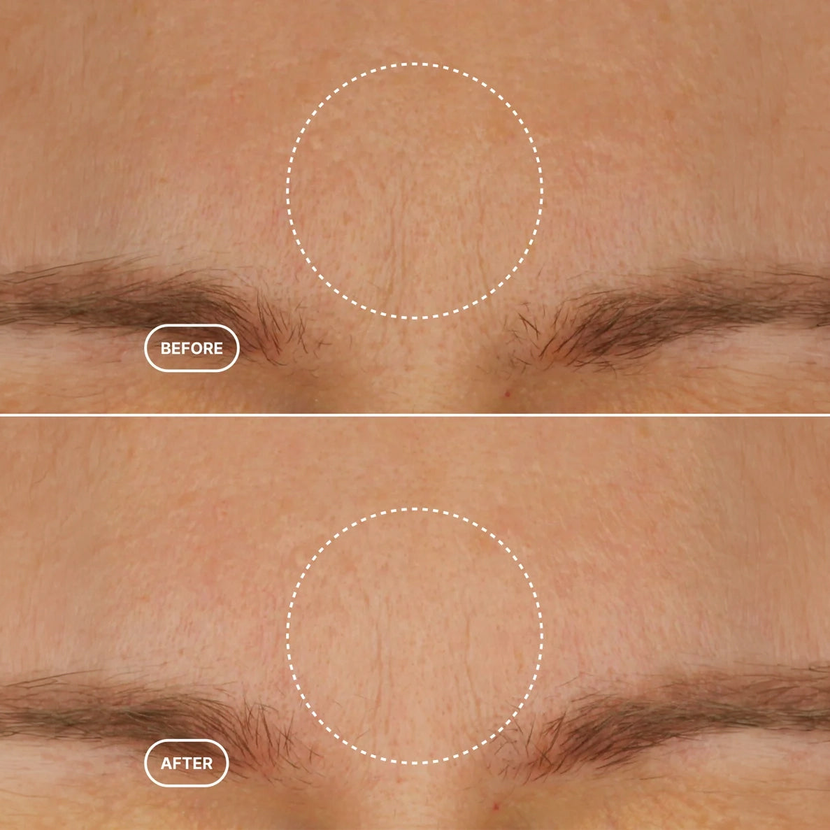 Retinol Alternative Moisturiser