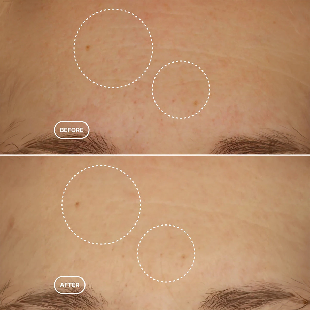 Retinol Alternative Serum